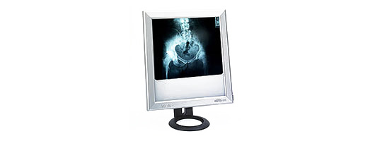 Weiko X-ray Viewer