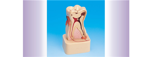 Tooth Disease Models