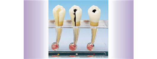 Endodontics Models