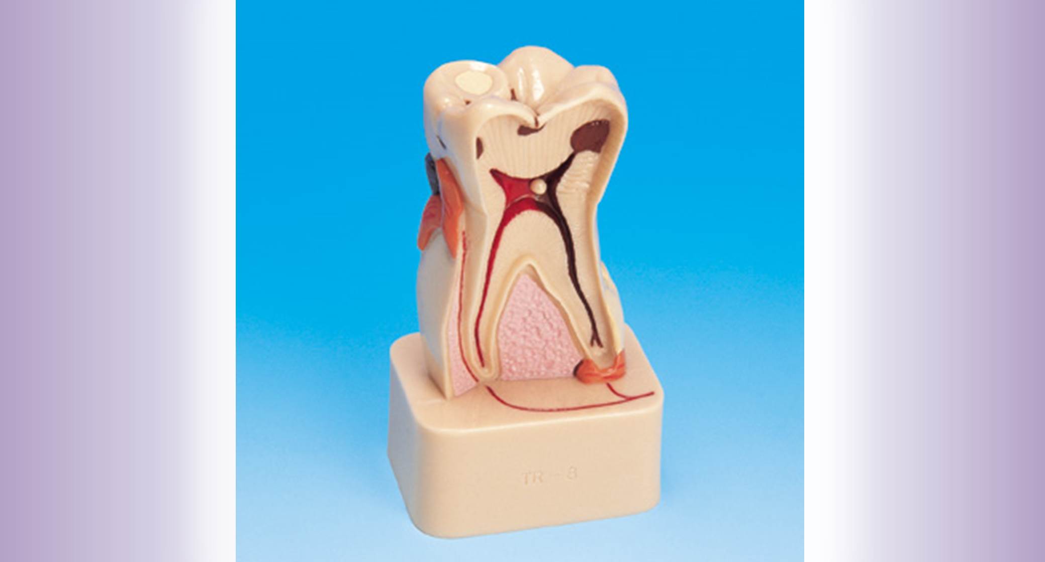 Tooth Disease Patient Education Models