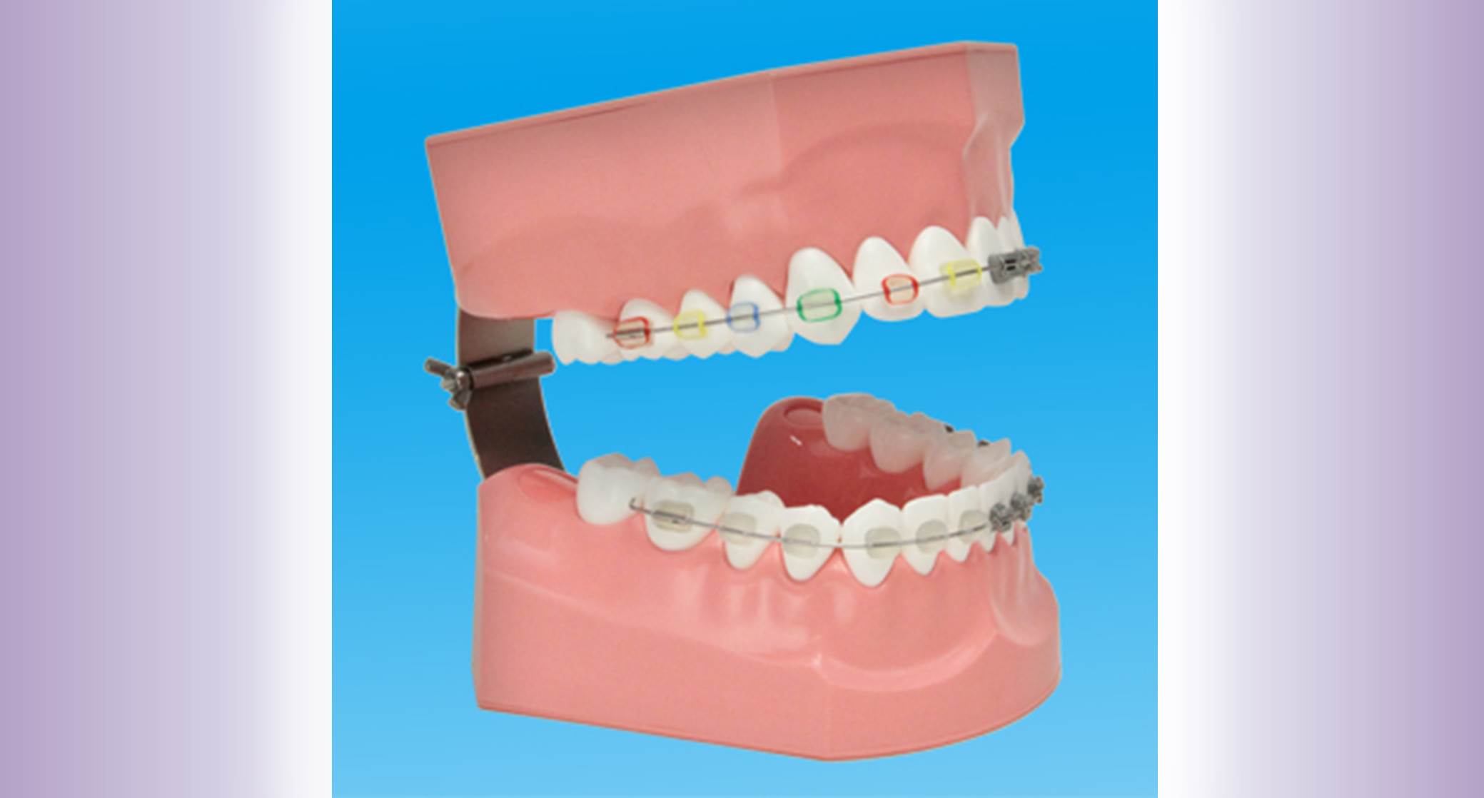Orthodontics Patient Education Models