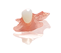 SunFlex® Unilateral Partial Dentures