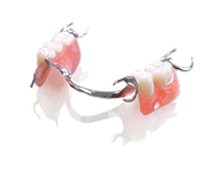 SunFlex® Combination with Cast Partial Dentures