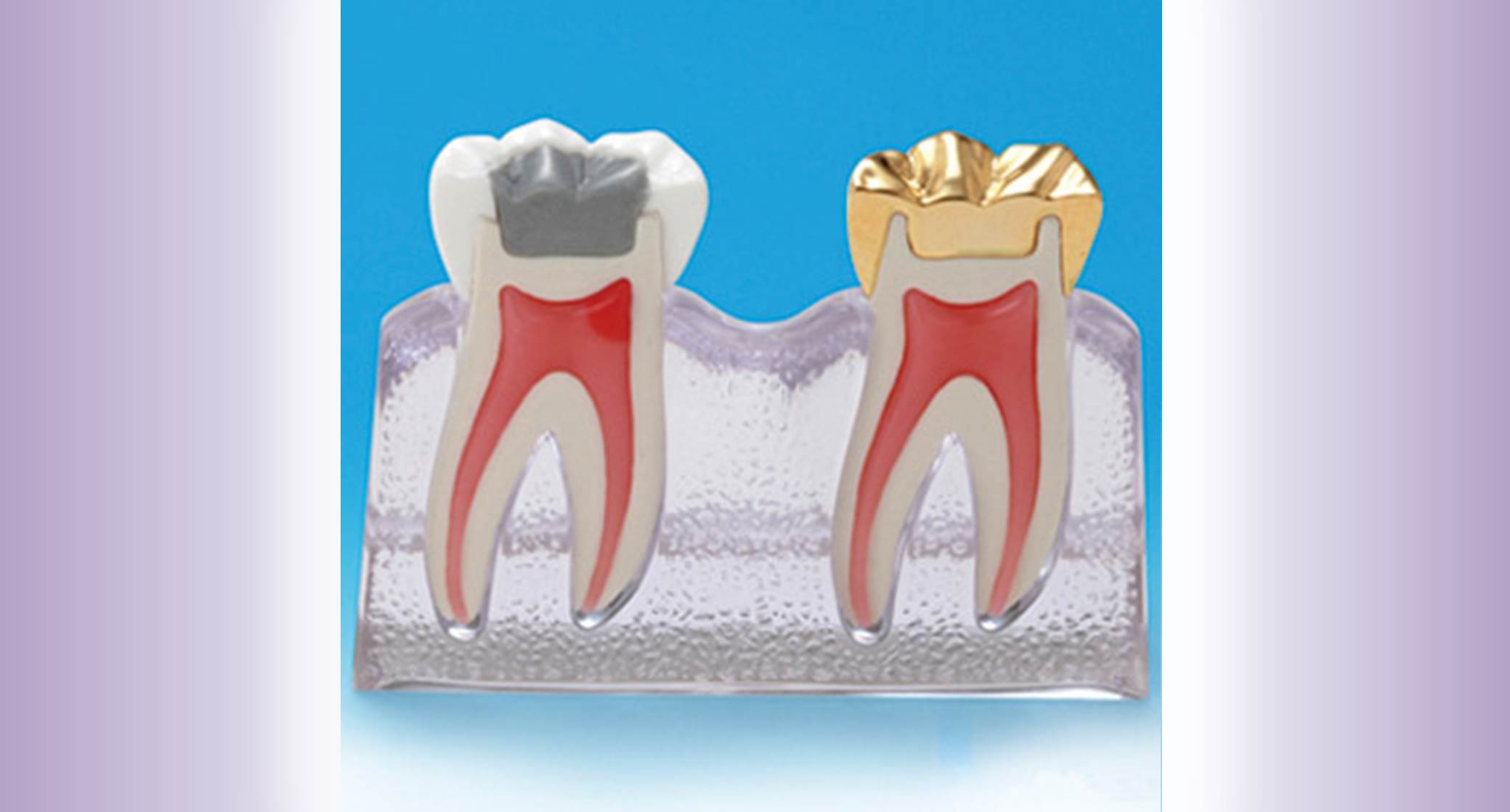 Prosthodontics Patient Education Models