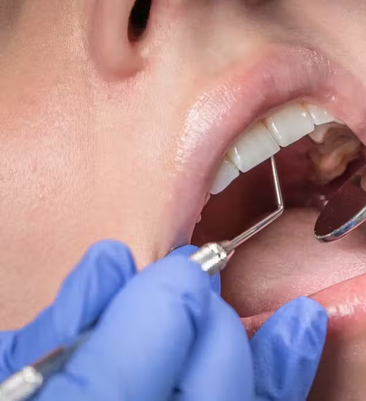 Digital Smile Design Dentistry UK