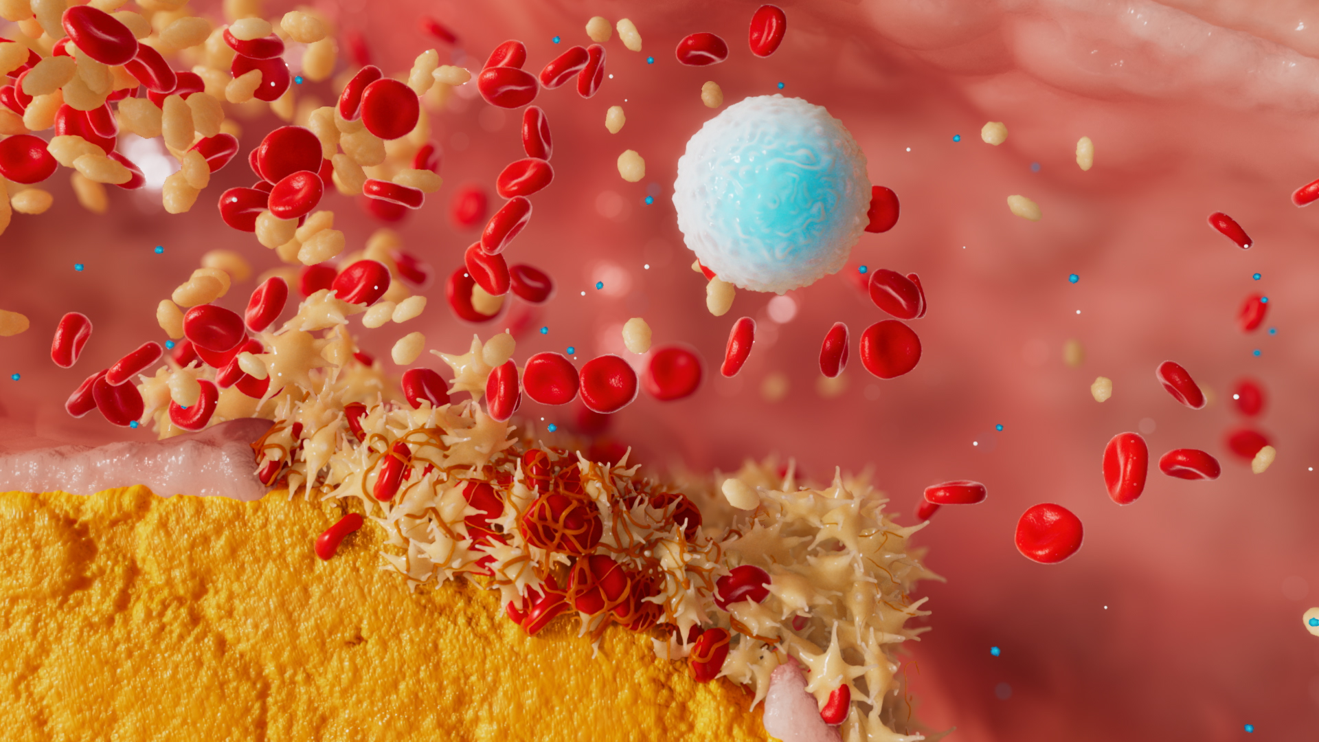 3D medical animation showing red and white blood cells moving through an artery with plaque build-up along the arterial wall.