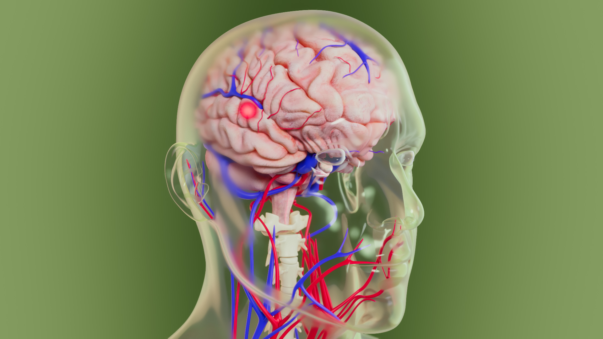 3D medical animation showing the human brain and vascular system, with a highlighted area of the brain illustrating a neurological condition or treatment target.