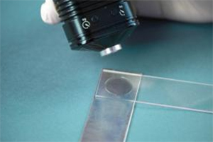 Biocompatible UV Curable Adhesive Formulated for TPU Bonding