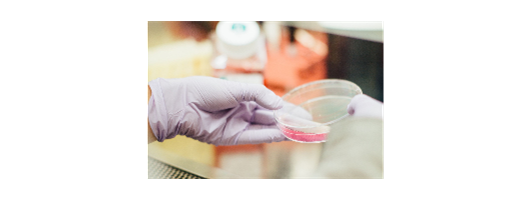 Viral Vector Selection and Manufacturing for Cell and Gene