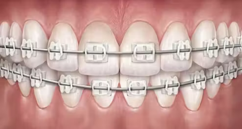 Award Winning Dental Clinic UK