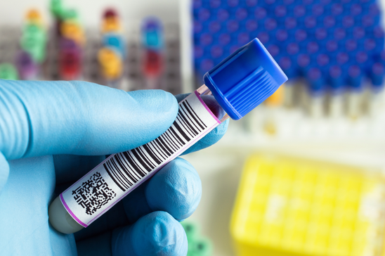 Barcode Label Manufacturing